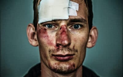 Man after a mountain bike accident